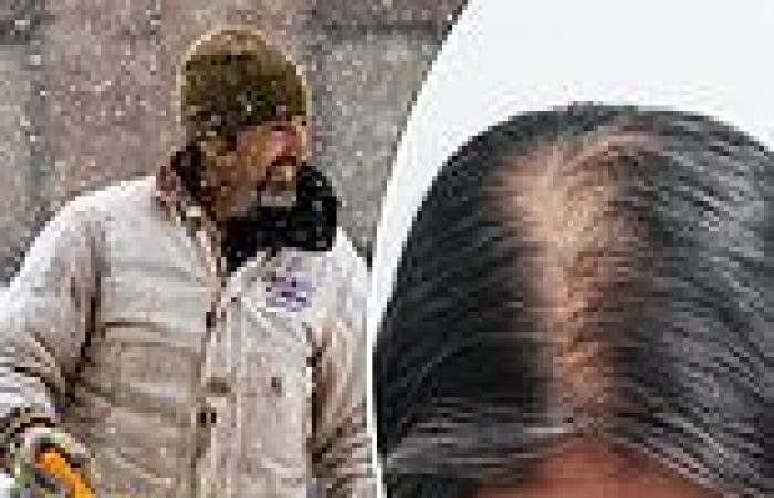 Expert warns that the cold weather can make your hair fall out - and gives tips ... trends now