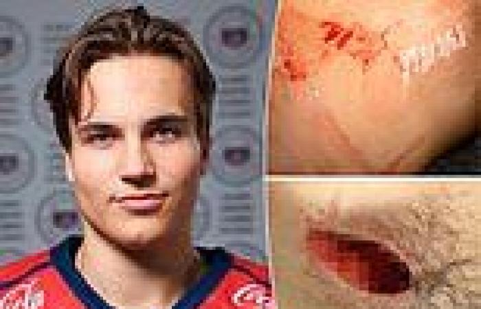 sport news Ice hockey is hit by new skate blade injury horror as 19-year-old player has ... trends now