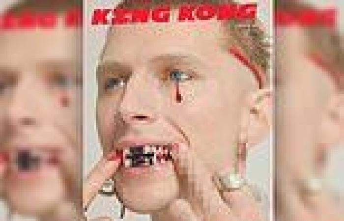 Machine Gun Kelly shows off METAL teeth while shedding a single bloody tear on ... trends now