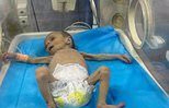 Just skin and bone: The starving Gaza toddlers kept in incubators as UN human ... trends now