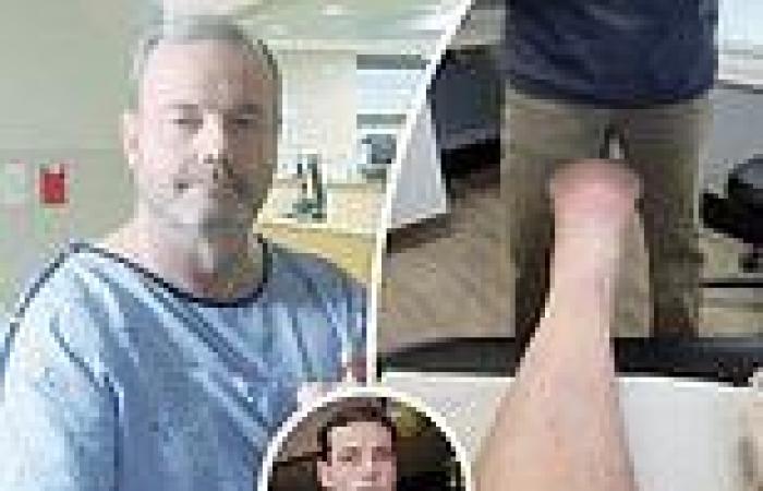 John Wayne Bobbitt has all of his toes amputated due to contaminated Camp ... trends now