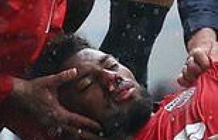 sport news Ex-Arsenal star, 26, 'stable' in hospital amid 'fears he had suffered a brain ... trends now