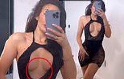 Chloe Ferry proudly shows off her breast reduction surgery scars in a daring ... trends now