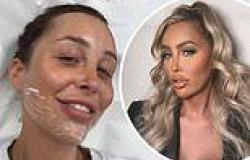 MAFS UK star Ella Morgan reveals she's getting her filler dissolved as she ... trends now