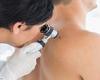 Skin cancer rate for men rises by HALF in ten years