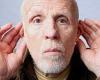 Hearing loss declines with physical fitness, study finds 