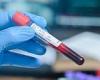 Blood test to spot pancreatic cancer could be available within months
