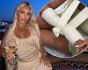 TOWIE's Amber Turner breaks her wrist while on holiday with co-star pals in ...