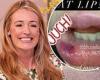 Cat Deeley reveals swollen lip as she shares painful snap after being ...