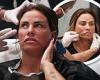 Katie Price shares her fourth face lift in a YouTube video after filming the ...