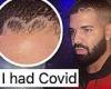 Drake reveals he had COVID-19 as he says the virus is the reason for his ...