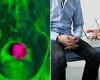 Prostate cancer sufferers could be cured in two weeks with new radiotherapy