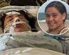 Florida teen who spent 11 days of ventilator due to COVID-19 urges peers to get ...