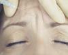Could BOTOX protect people from getting Covid?