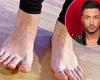 Strictly's Giovanni Pernice shares video of celebrity partner's bruised and ...