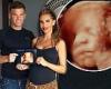 Pregnant Danielle Lloyd and her husband Michael O'Neill proudly show their 3D ...