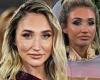 Megan McKenna embraces a more natural look since ditching the lip filler after ...