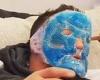 sport news Michael Chandler posts video of UFC star  wearing an ice mask because his face ...