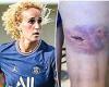sport news PSG Women's star Kheira Hamraoui's cut and bruised legs from night she was ...