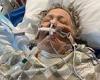 Unvaccinated mother, 69, wakes from month-long coma on day family were taking ...