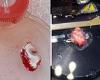 Slice of human BRAIN is kept alive in a petri dish for 12 hours for the first ...