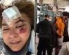 Woman, 56, who broke her neck after she was shoved by a stranger in NYC subway ...