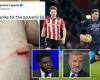 sport news Aymeric Laporte shows off a nasty gash on his leg after Stuart Armstrong's high ...