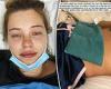 NRL WAG and Crohn's sufferer Tahlia Giumelli is suffering 'horrendous bloating ...