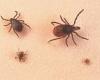 Sunday 8 May 2022 01:14 AM GPs urged to spot the early signs of Lyme disease trends now