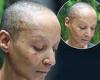 Friday 13 May 2022 08:26 PM Adele Roberts reveals chemotherapy left her with 'burned' skin on her face trends now