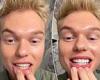 Tuesday 17 May 2022 12:07 AM Jack Vidgen shows off his impressive smile transformation in dramatic before ... trends now