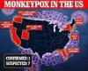 Tuesday 24 May 2022 10:01 PM California officials find 'likely' case of rare monkeypox virus trends now