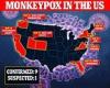 Friday 27 May 2022 06:07 PM CDC panel recommends monkeypox vaccine for lab workers, health responders and ... trends now
