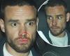 Wednesday 15 June 2022 05:31 PM Liam Payne suffers a nose bleed as he leaves a night out at 3am with a mystery ... trends now