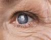 Sunday 26 June 2022 12:15 AM One in five Britons don't know what a cataract or glaucoma is, poll finds trends now