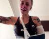 sport news Aussie UFC star whose arm was badly broken accuses opponent of fighting dirty ... trends now