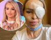 Tuesday 16 August 2022 08:10 PM Katie Piper is rushed into emergency surgery with 'extreme pain' in her eye ... trends now
