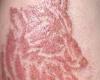 Friday 19 August 2022 04:16 PM Turkey wolf henna tattoo could leave 10-year-old girl scarred after it caused ... trends now