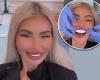 Saturday 10 September 2022 01:46 AM 'Feel like me again': Chloe Sims flashes her dazzling new teeth after visiting ... trends now