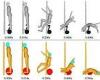 Wednesday 21 September 2022 12:17 AM Driving posture affects electric scooter riders' injuries in accidents trends now