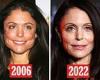 Tuesday 22 November 2022 07:44 PM Bethenny Frankel candidly reveals her past procedures and her future plastic ... trends now