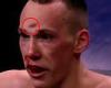 sport news Horrific moment kickboxer ends up with a divot in his forehead as a knee strike ... trends now