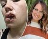 St Louis mother, 30, left disfigured after her friend's pet dog ripped off her ... trends now