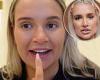 Molly-Mae Hague hits back at fans who said she's been having lip filler while ... trends now