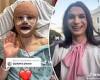 Transgender influencer shows off scarred face after undergoing facial ... trends now