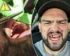 sport news UFC star Kelvin Gastelum has his teeth STITCHED back into his gums after brutal ... trends now