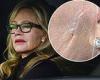Melanie Griffith, 65, is seen with scar on the left side of her face while out ... trends now