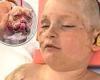 Boy, 11, who suffered horrific injuries after being mauled by three pit bulls ... trends now