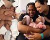 Conjoined twin babies AmieLynn and JamieLynn separated after painstaking ... trends now
