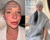 Aspiring actress, 30, diagnosed with brain tumor after homeless man punched her ... trends now